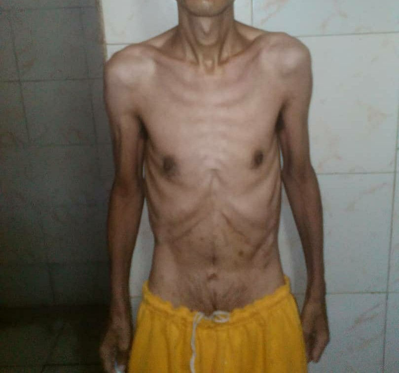 MIRANDA | Otorgan libertad a preso con cuadro de desnutrición